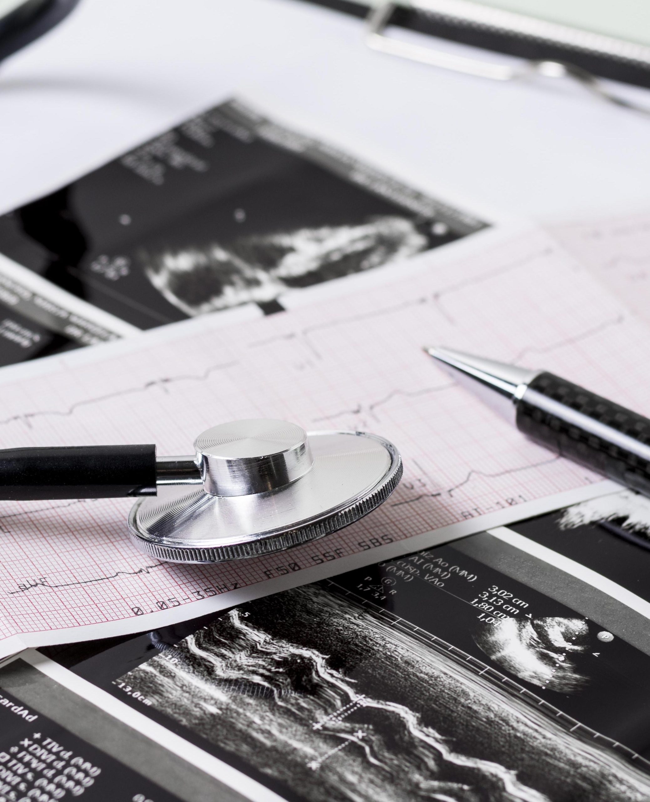 Studie Precision CVD: Risikofaktoren bei Herz-Kreislauf-Erkrankungen